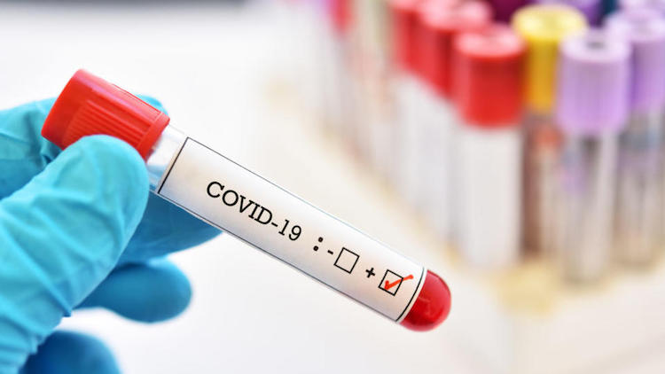 St. Vincent de Paul and CVS Offering Free Coronavirus Tests